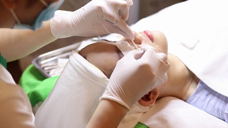Cách chăm sóc da sau nặn mụn đúng cách để da phục hồi nhanh